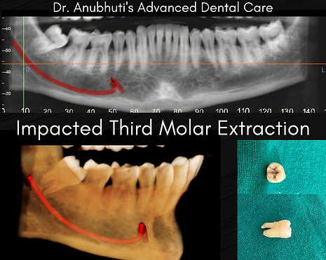 Anxiety-Free Dental Visit