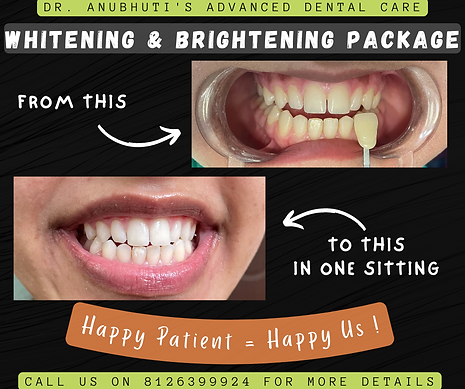 Single-Visit Precision Root Canal