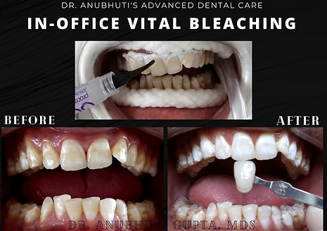 Aesthetic Smile Enhancement